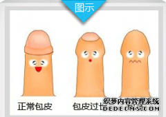 龙岩那家医院做包皮?男性包皮过长的现象已经很常见了，很多男性朋友已经认识到了包皮过长的危害，因此及早的进行了包皮手术，避免了包皮过长带来的危害。但是有些男性朋友仍然