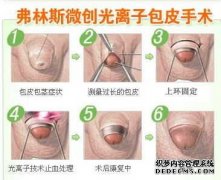 男性的包皮 是具有保护器官的作用的，由于 包皮过长 临床上的患者很多因为包皮过长带来的疾病。所以在此男性包皮过长一定要高度重视，男性的包皮过长会让男性感到很困扰，疾病