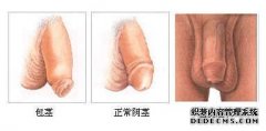 龙岩割包皮的医院?对于患有 包皮过长 的男性来说，及时的治疗是明智的选择。可是在选择医院的时候很多男性都很纠结。不知道哪些医院能够很好的治疗包皮过长，针对这一问题，下
