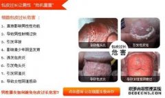 在生活中很多男性朋友经常生出抱怨，说自己的性生活质量差，在性生活中出现了一系列的问题，这很可能是男性包皮过长所致，男性朋友应及早的做出判断，查看自己是否存在包皮过
